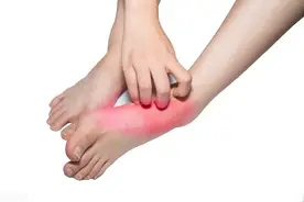 脚痒？5种实用方法与建议，你知道吗？图片