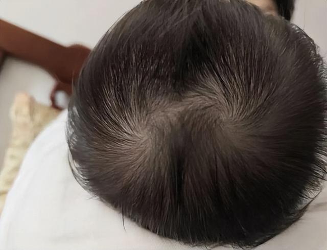 孩子头顶“2个旋”，到底代表什么？父母别不在意，看完涨知识了