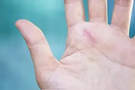 被自家狗蹭破皮，要打狂犬疫苗吗？医学指南建议：这些情况必须打图片