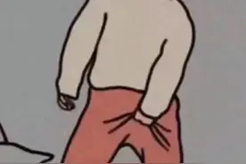 瘙痒难忍——让人“羞于启齿“肛周湿疹”图片