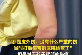 重庆12岁男孩被生父和继母殴打至遍体鳞伤！其父首次发声图片