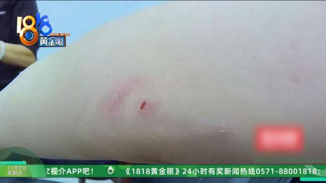 怎么又是这？她还拿出视频，里面“一动不动”，停了几只苍蝇....