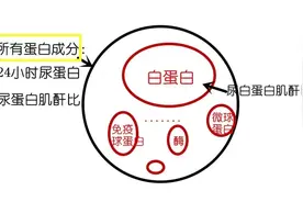尿（微量）白蛋白肌酐比和尿蛋白肌酐比的关系是什么？图片