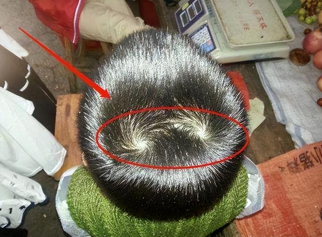 孩子头顶“2个旋”，到底代表什么？父母别不在意，看完涨知识了