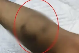 三岁男童被生父女友虐待致脑死亡？警方：已刑拘图片