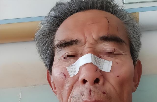 68岁保洁被游客群殴后续：伤情曝光是退伍老兵，警方介入网友炸锅