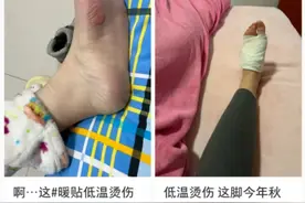 一觉睡醒，身体突然出现水疱？！多是因为同床共枕的它 ……图片