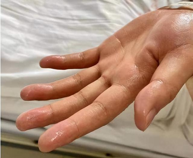 人出三汗，命不长久？医生提醒：出现这4种异常，或是大病预警