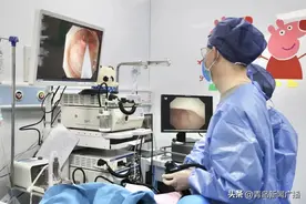 不开刀，内镜下即可治疗，这项新技术帮你保住阑尾......图片