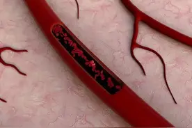 血管堵没堵，头部最清楚，若出现这5种症状，须警惕图片