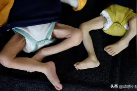 罕见照片，加沙大量的巴勒斯坦人快被饿死了，儿童饿得骨瘦如柴图片