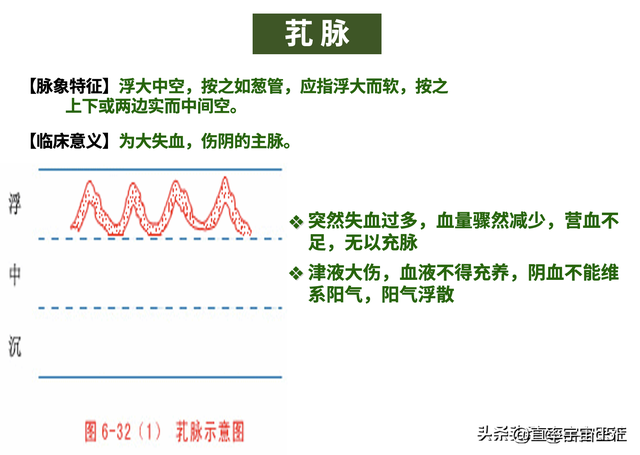 中诊入门：浮、散、革、芤脉，沉脉对比伏、牢脉，文末附《指法》