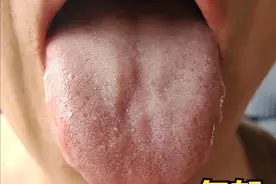 肝郁与食郁、湿郁、痰郁、火郁、血郁有什么区别？解郁有何不同？图片