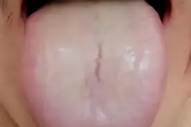 气越顺，痰越少！柴胡舒肝丸这样用，化痰湿 祛血瘀，还你一身清爽图片
