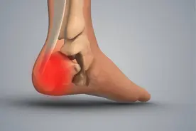 脚后跟痛别大意，可能是5种病在“惹事”！缓解方法，来看看图片