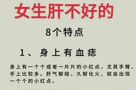女生必看！肝不好竟有这8大特征，三款养肝茶帮你轻松调理图片