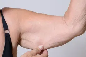 人不会无缘无故患肌肉萎缩！调查发现：得肌萎缩，离不开这4点图片