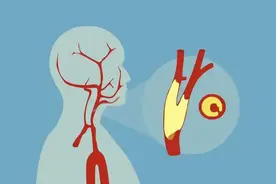 血管年轻，人才年轻！手背血管有这6个特点，恭喜你容易长寿图片