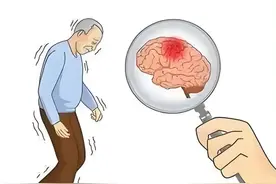 科学预防急性脑梗：从生活细节做起图片