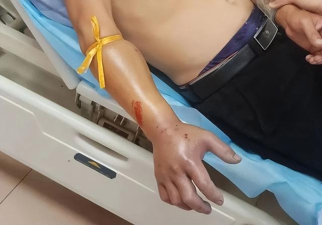 24小时夺命！浙江接连有人被海鲜刺伤离世，这种菌很凶险