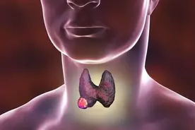 “药王”孙思邈，祛湿第一方！加减后化痰散结，消一身结节包块图片