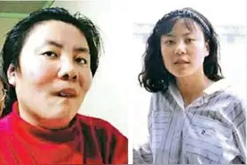 什么是铊中毒？中毒后又会出现哪些症状？我们该如何警惕和预防？图片