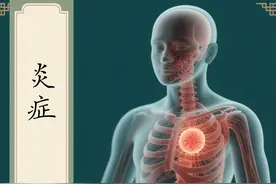 银屑病：被忽视的炎症才是最大元凶图片