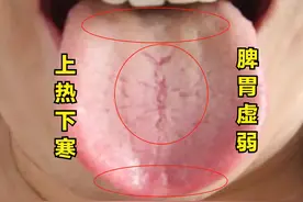 别再引火归原了！这样的上热下寒越引越上火图片