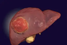 这6种坚果，是天然护肾王，补肾阳、益精血，肾囊肿患者应该多吃图片