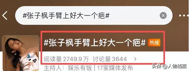 张子枫丝巾裹胸，曝浑身伤痕胸前、手臂都有，才懂成龙话的含金量