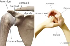 8种肩关节前脱位复位方法总结---总有一种适合你图片