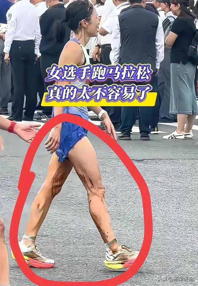 切片时代的祭品：张水华勤恳13年零医疗失误，被生理期几句话抹杀