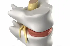 【昆明康复科】关于脊髓损伤你了解多少?图片