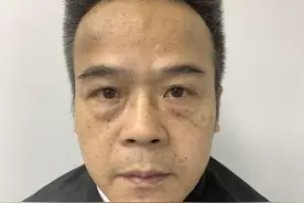 50岁怕疼犹豫小半年，还是选择做了不开刀去眼袋，真实感受分享！图片