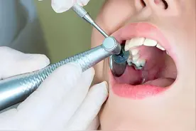 当智齿发炎时，医生并不建议马上拔除，这是为什么呢？建议了解图片