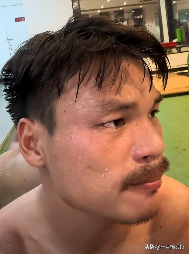 被封一年后，小杨哥老婆“露头”探风口，医美痕迹和目的都很明显