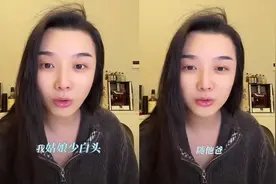王栎鑫少白头遗传给女儿，唯伊才9岁就有白发，吴雅婷直呼很心疼图片