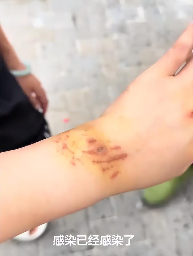 生理期潜水被鲨鱼咬伤，谁在助长“玩命出片”的疯狂？