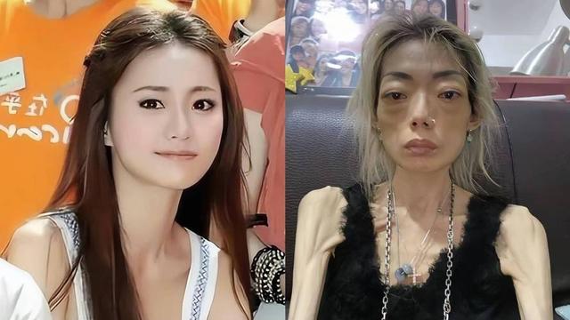 豪门玩物，8年被折磨成牙齿全掉，不足80斤，形似骷髅，惨不忍睹