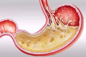 一张嘴就尴尬？你的口臭可能来自这里，第2个很多人中招！图片