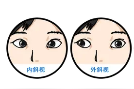 孩子总“歪头卖萌”，当心得了这种病！图片
