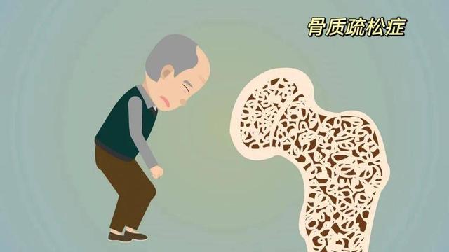 腰背佝偻，记忆减退，父母衰老如斯，需要被关注！