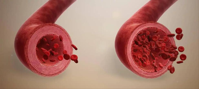 长期喝茶的人	，最后都怎样了？研究发现：每天2-3杯茶或可延寿