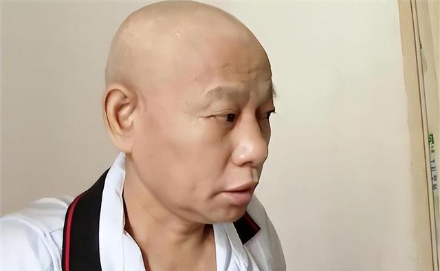 捐肾救妻的模范丈夫，12年后住院发现双肾都在，子女表示无法接受