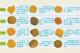 婴儿大便典型颜色性状及身体健康（图解）图片