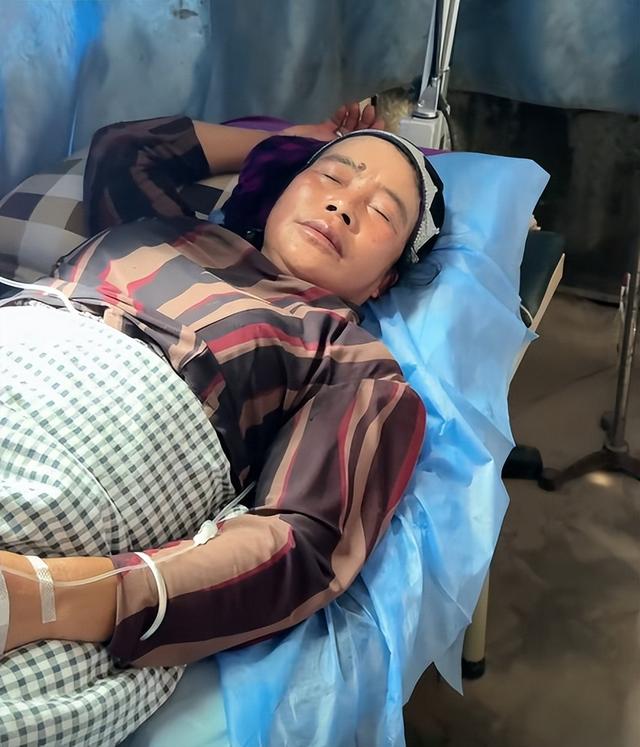 云南大姨被蜜蜂狂蜇，满脸蜂刺求助，过路司机惊呆，网友直呼惊险