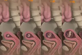 怀孕3个月，胎儿的样子，已经人模人样？图片