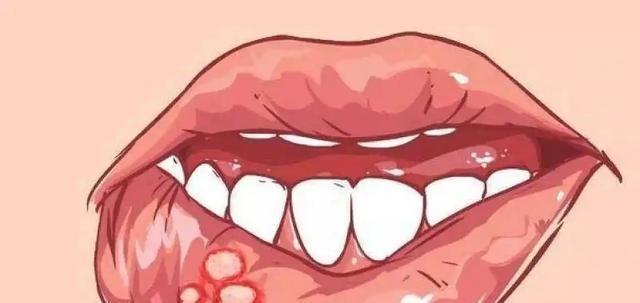 12月21冬至，传统吃饺子，提醒：2馅不上桌	，福气不进门，正当季