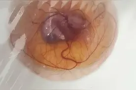 湖南男子连续12天直播孵化无壳受精鸡蛋引围观，专家：很难图片