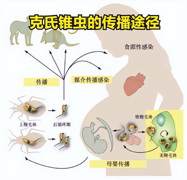 美国爆发新型疾病，传播速度快症状致命，我国暂未输入但须警惕！